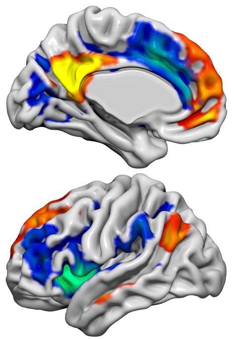 hormone alters male brain networks to enhance sexual and emotional