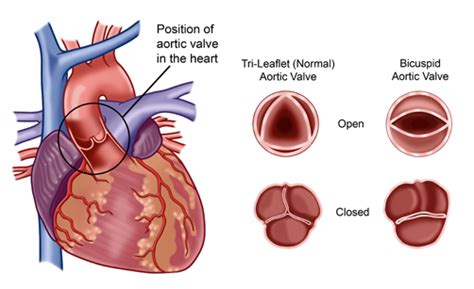 inima anatomie valve artere cardiologie dr benteu darius