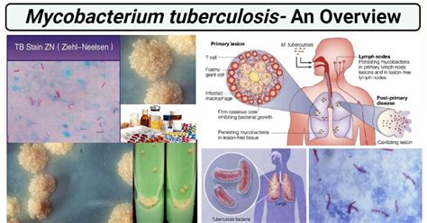mycobacterium tuberculosis shape