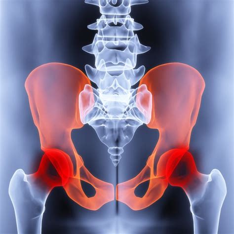 groin injuries groin injury symptoms  treatment