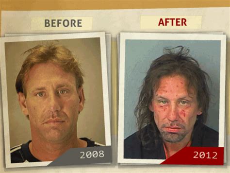 photos before and after faces of addiction pictures show impact of drugs on men women wjla