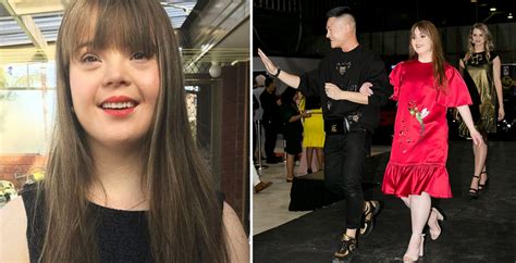 australian model with down syndrome debuts on the catwalk