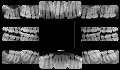 digital  rays buffalo grove illinois drs papworth  vargas family dentistry