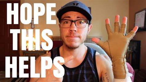 Ftm Phalloplasty Hand Swelling Solutions And Pee Update Youtube