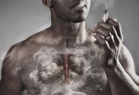 Emphysema Symptoms Treatment And Causes