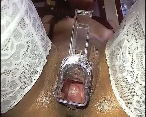 polys gaping pussy speculum show free porn 84 xhamster