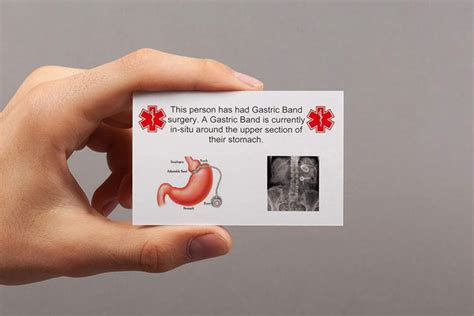 gastric band medical alert emergency id plastic card wallet size