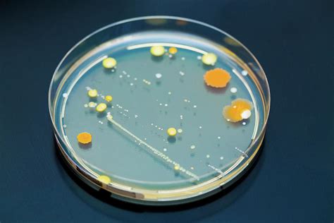 bacteria   petri dish photograph  wladimir bulgarscience photo