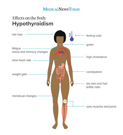 symptoms of hypothyroidism underactive thyroid