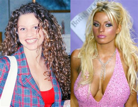 katie price plastic surgery before and after photos
