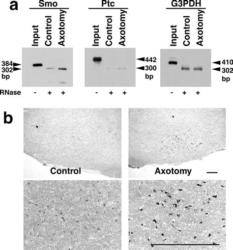 the upregulated expression of sonic hedgehog in motor neurons after rat