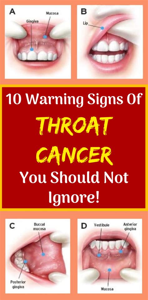warning signs  throat cancer    ignore