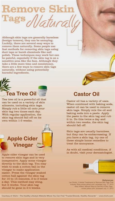 how to remove skin tags naturally [infographic] using tea tree oil