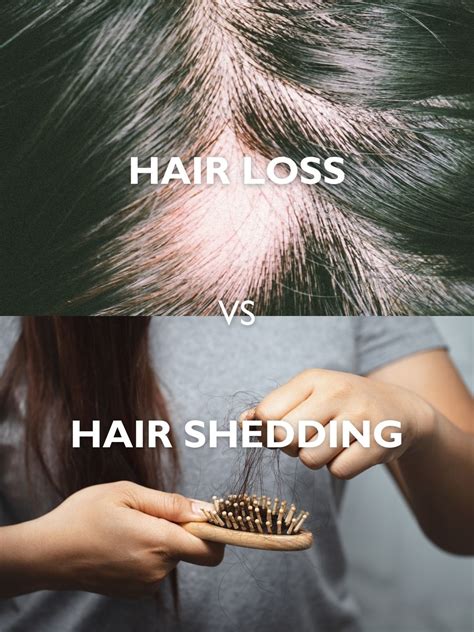 top  image pictures  normal hair loss  shower thptnganamsteduvn