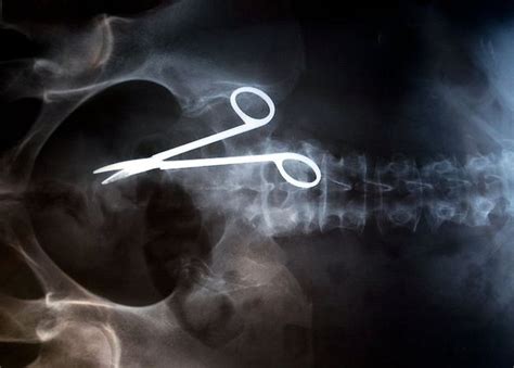 20 of the world s most bizarre x rays x ray medical medicine