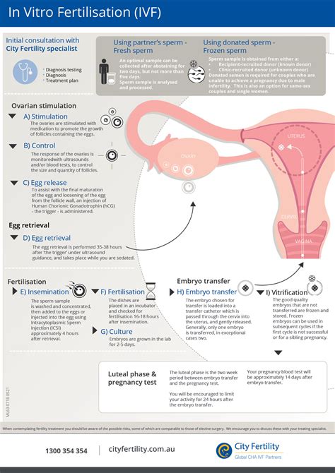 Ivf Fertility Treatment Process City Fertility