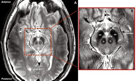 brain  spines    mid brain nuclei anatomy