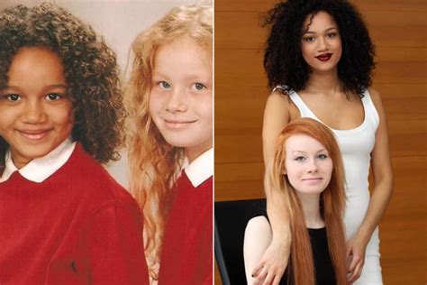 Biracial Twin Sisters Born To A White Father And A Half Jamaican Mother