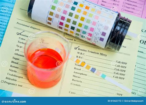 reagensstrook voor urineonderzoek routineurineonderzoek urinetest ch stock afbeelding image