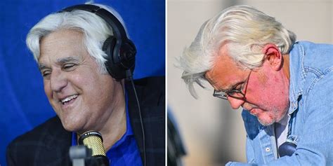 Jay Leno Wants To Joke About His Facial Burns There S Nothing Worse