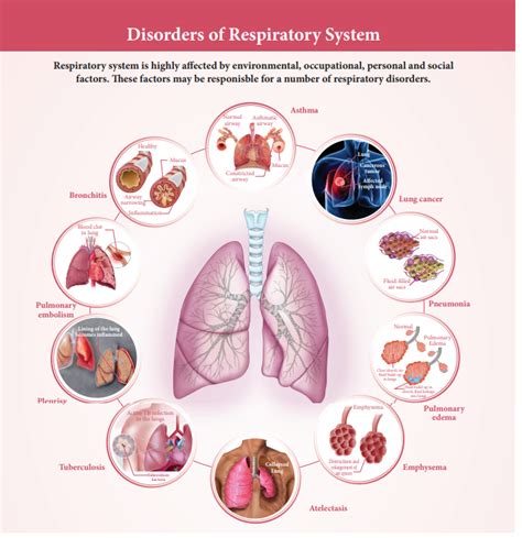 Respiratory System Disorders Broward Miami Health Institute