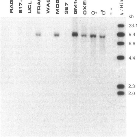 Pdf Isolation And Characterization Of A Steroid Sulfatase Cdna Clone