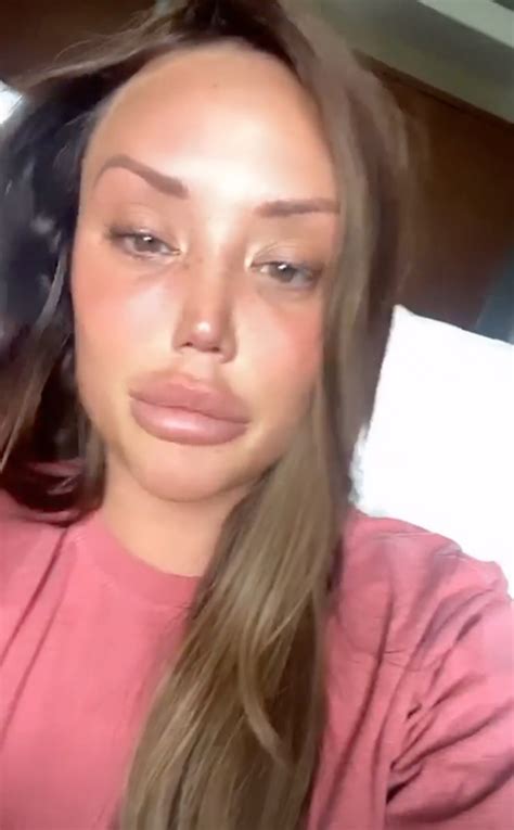 charlotte crosby denies beating up ex josh ritchie while he slept