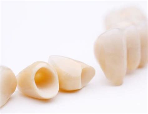 premium quality all ceramic crown abroad dental