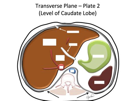 Transverse Plane Plane 2 Level Of Caudate Lobe Diagram Quizlet