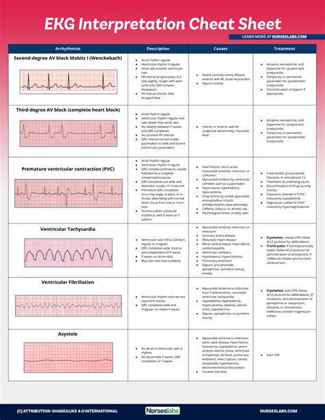 ekg interpretation cheat sheet heart arrhythmias guide  update