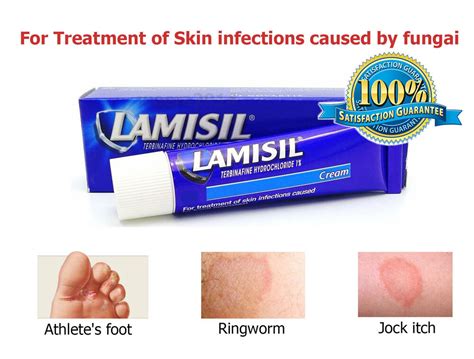 new lamisil cream 1 terbinafine treatment fungal skin infection athlete s foot ebay