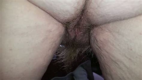 mature whore with cellulitis flabby ass flashed hairy
