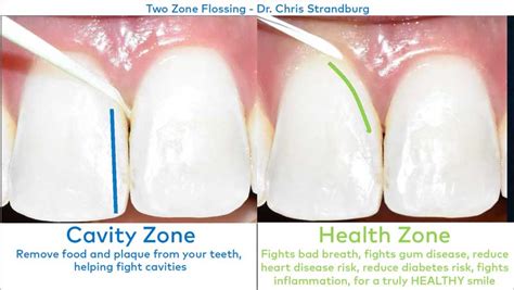 power  prevent dental disease waterpik singapore