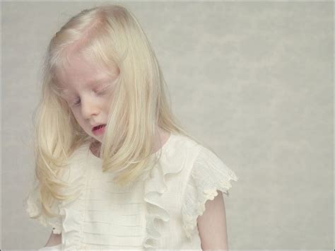 albinos project  gustavo lacerda