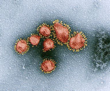 pin  electron microscopy