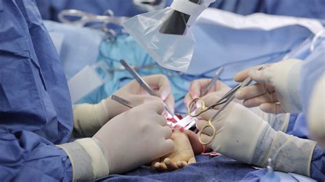 hand surgery hand surgery organ transplant childrens hospital