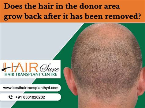 hair   donor area grow      removed cyber hairsure