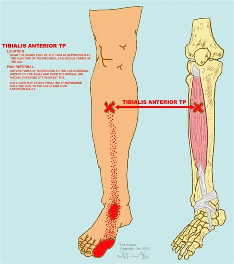 muscle tests illustrations foot pain chart ankle exercises cardiac rhythms trigger point