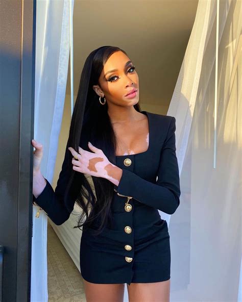 Winnie Harlow Sexy In Tiny Black Dress 9 Photos The