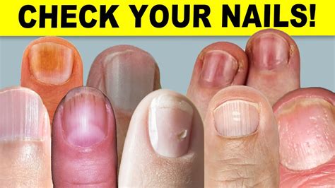 9 things your nails can tell you about your health uohere