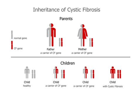 what is cystic fibrosis cystic fibrosis dna
