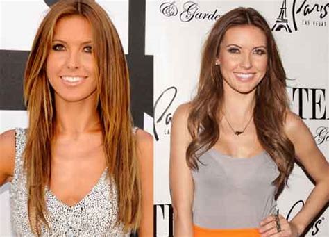 Audrina Patridge Plastic Surgery Before And After Pictures