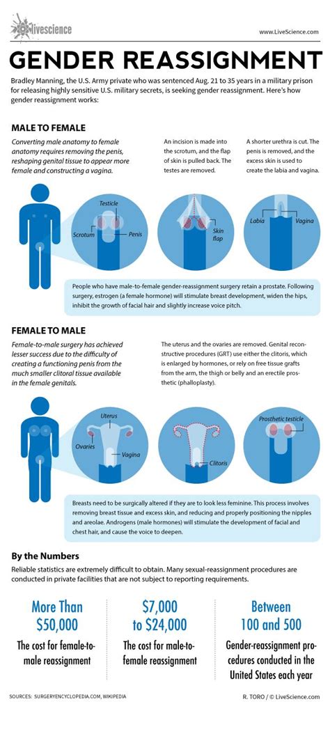 How Gender Reassignment Surgery Works Infographic Live