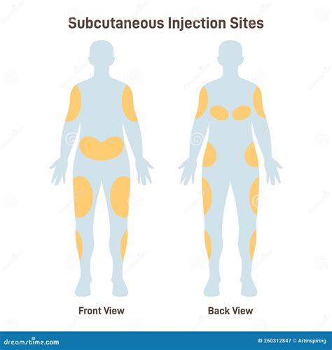 subcutaneous injection sites medicine injection sites   human