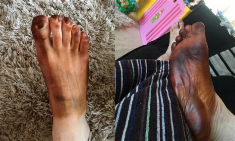 men s feet stained with fake tan after wives use socks as