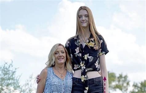 17 летняя девушка побила рекорд Гиннесса и теперь её ноги признаны