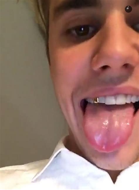 [pic] Justin Bieber’s Gold Tooth — See Biebs’ New Mouth