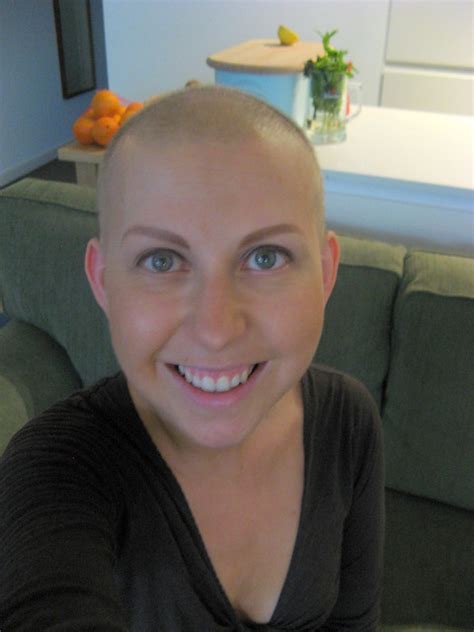 1 Month After Chemo Flickr Photo Sharing