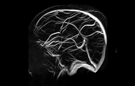 dubai neuro radiology center mri ct scan