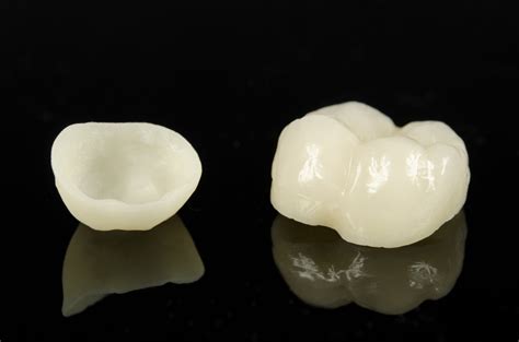 ceramic crowns dms dentistry